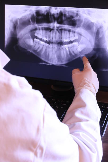 Best Emergency Dentist for Knocked-Out Tooth in White Plains, NC
