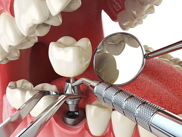 Best Emergency Cosmetic Dentistry in White Plains, NC