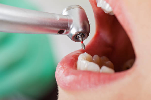 Best Mobile Emergency Dentist in White Plains, NC